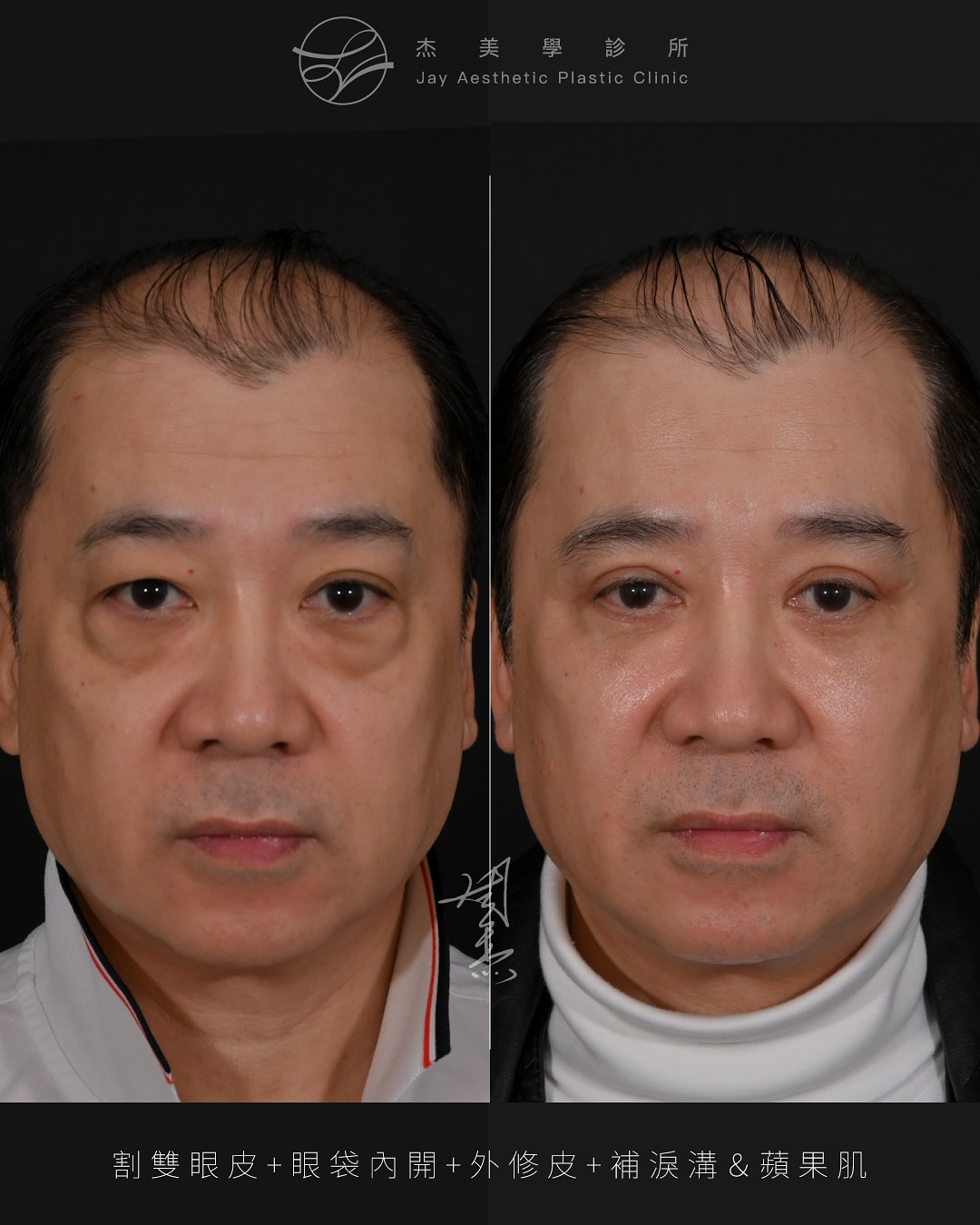 SnapInsta.to_533039504_18339165541160158_3619214226469761450_n