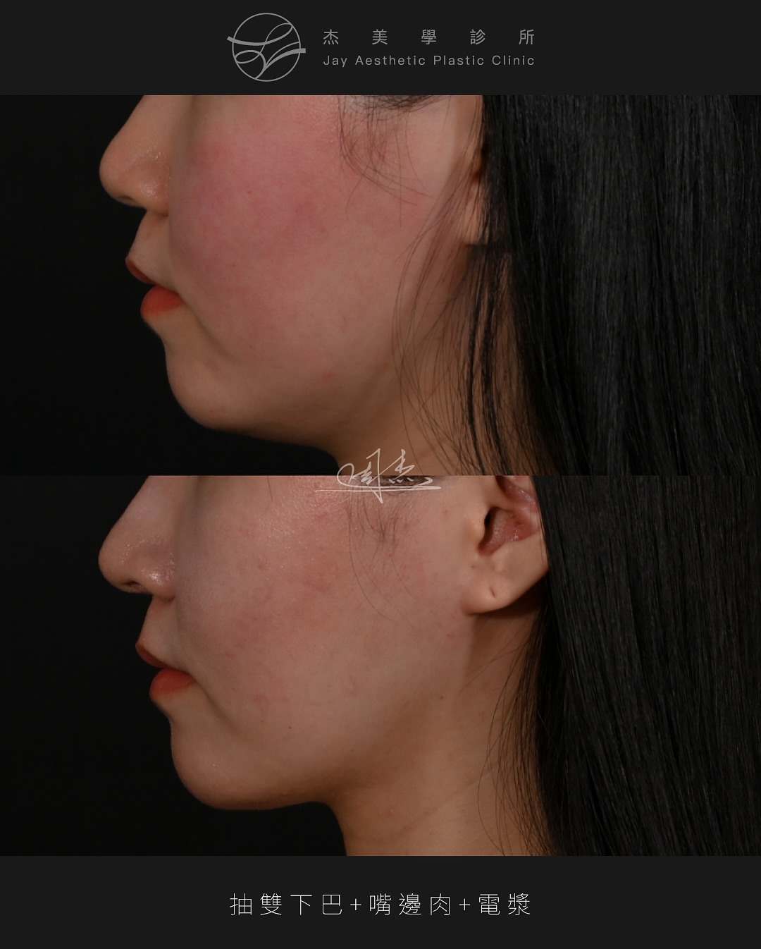 SnapInsta.to_545135361_18342263005160158_1122604112532120568_n