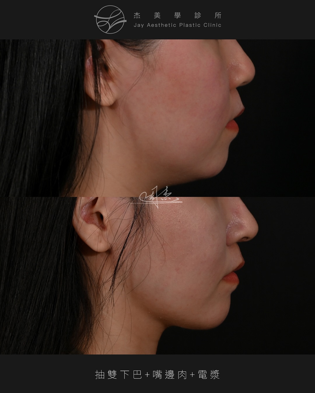 SnapInsta.to_546415239_18342263017160158_3039919113355920067_n