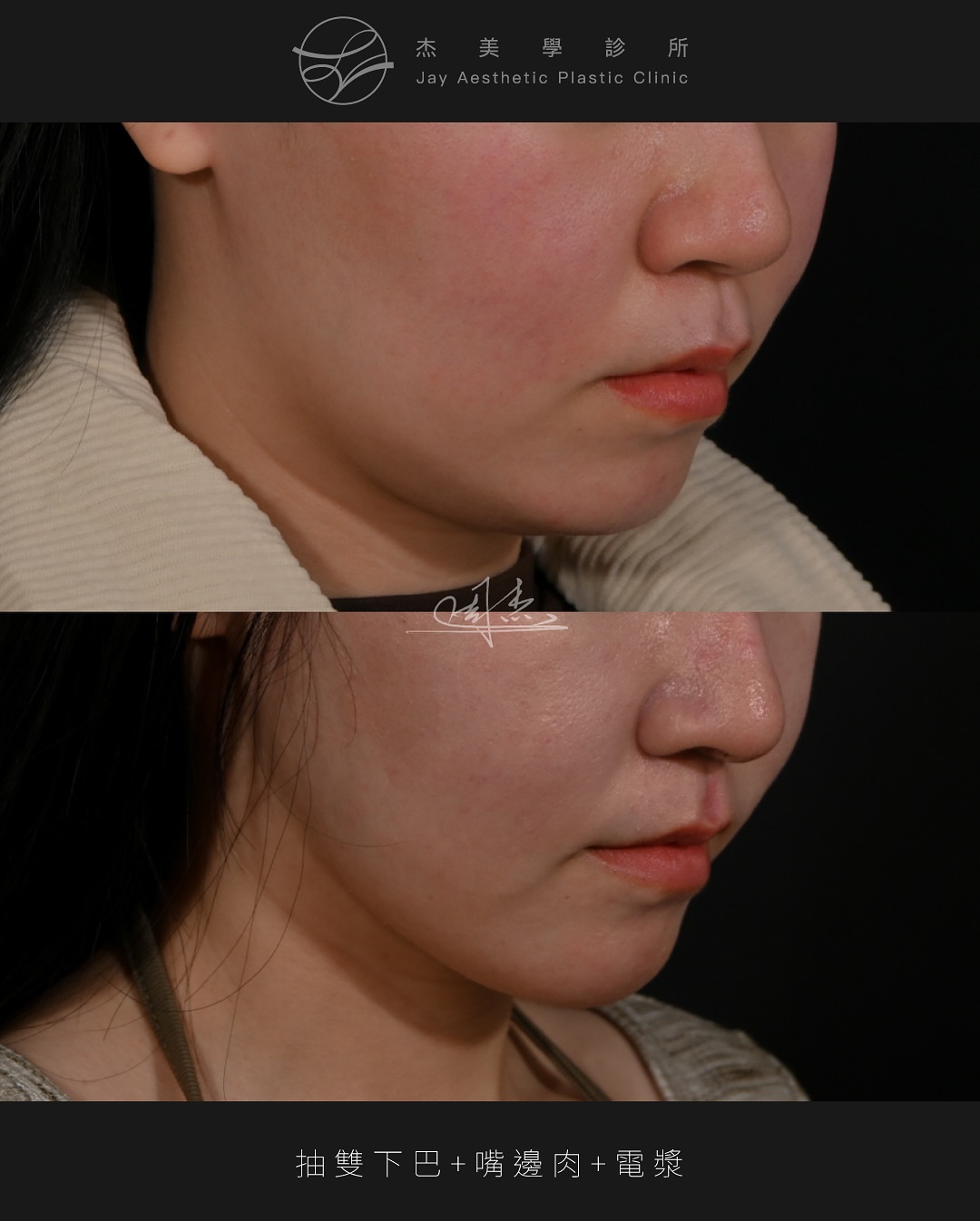 SnapInsta.to_546709581_18342262981160158_776744639724164024_n