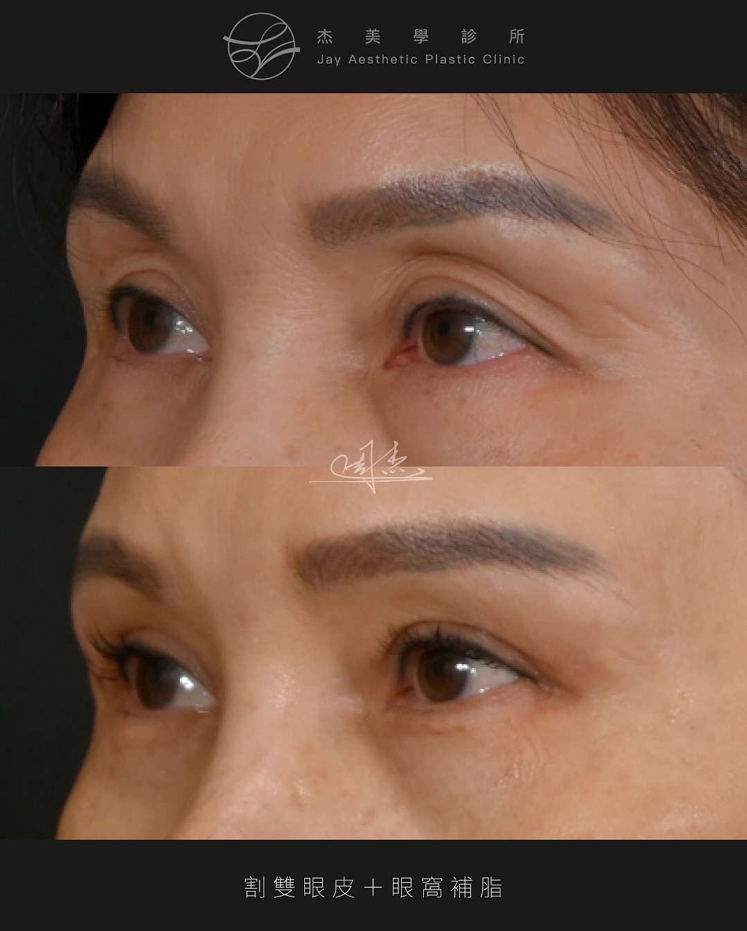 SaveClip.App_521707145_18336298240160158_1914182692805639340_n