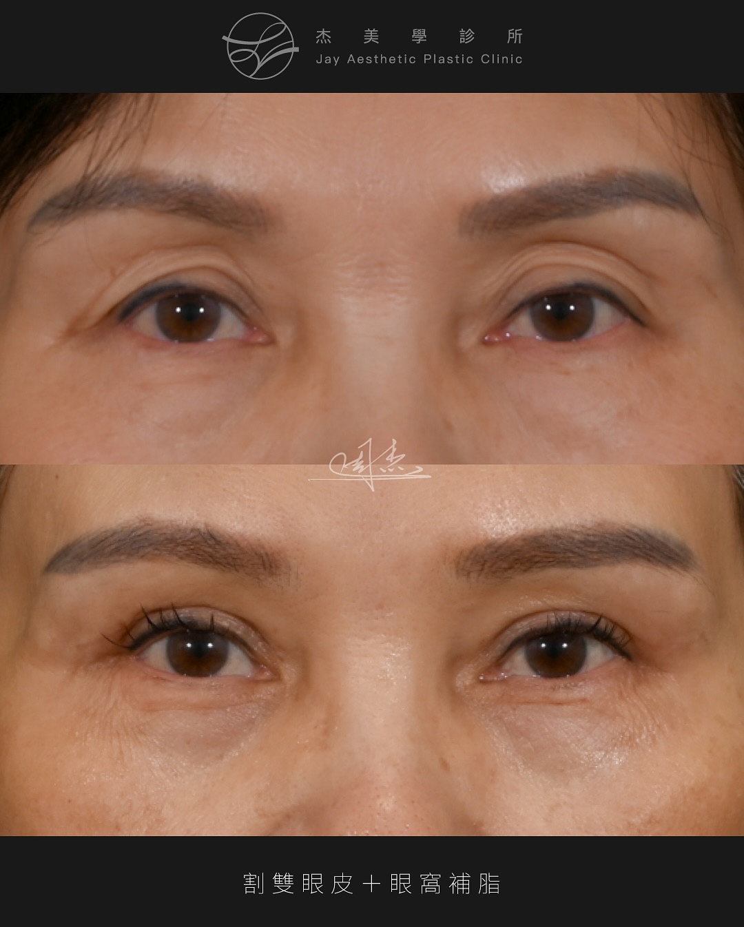 SaveClip.App_521722817_18336298231160158_8628769189592976758_n