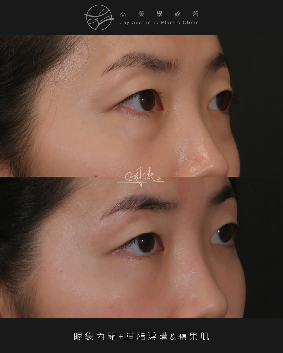 SnapInsta.to_503410577_18333385252160158_1020836785044253869_n