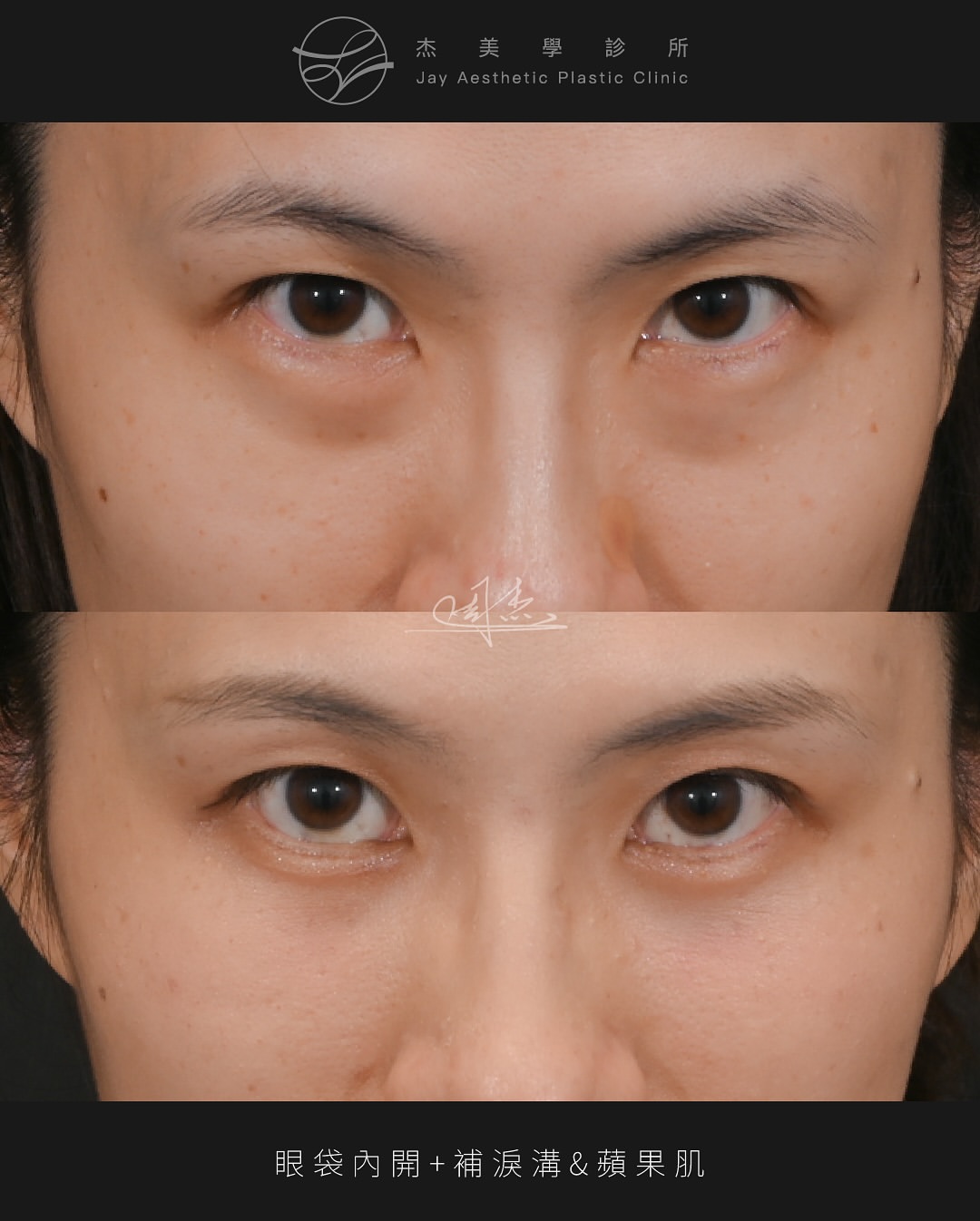 SnapInsta.to_505191055_18332664487160158_5146135744355965274_n