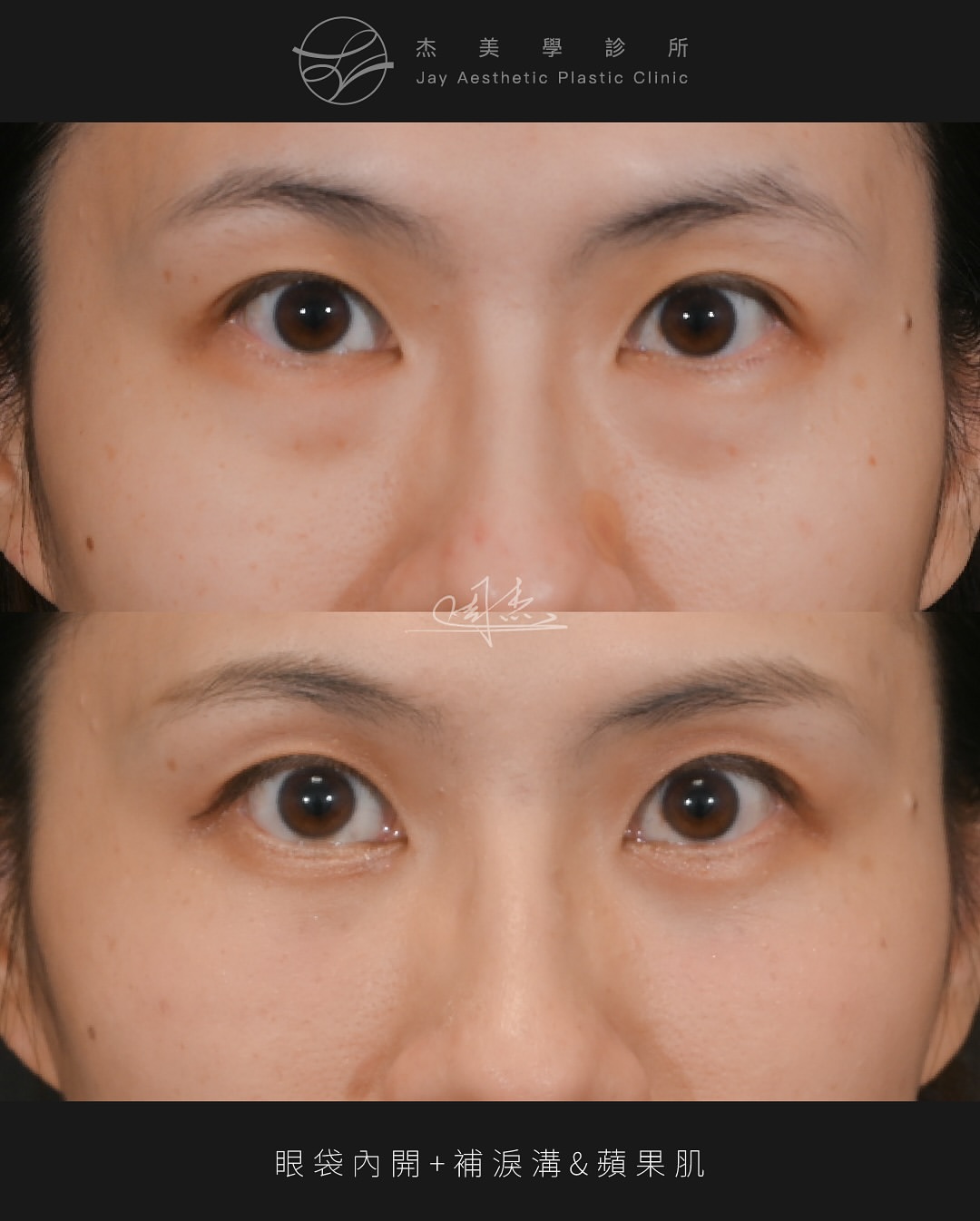 SnapInsta.to_506056244_18332664472160158_6353376988901405693_n