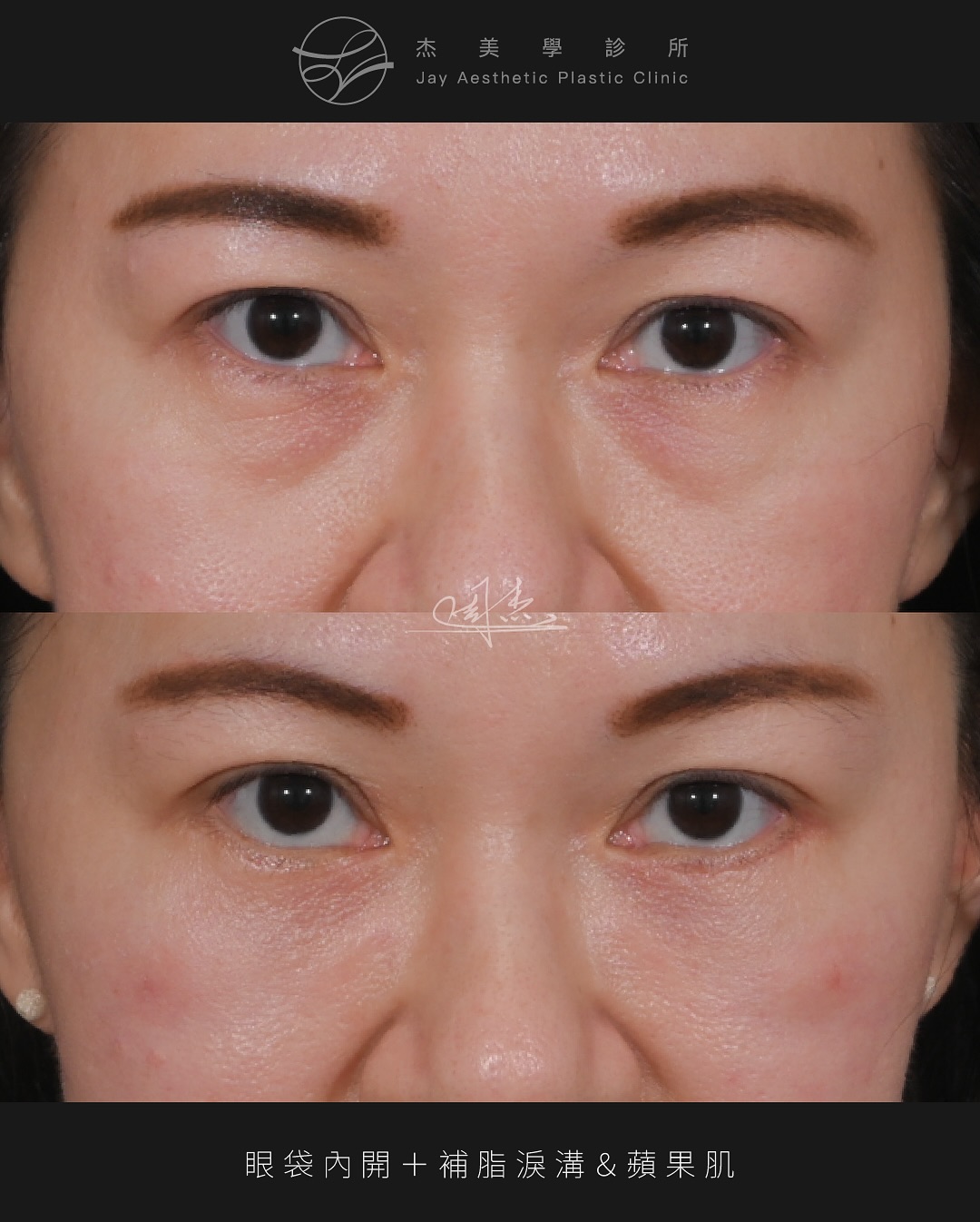 SnapInsta.to_514917416_18334716352160158_6838792597058502565_n