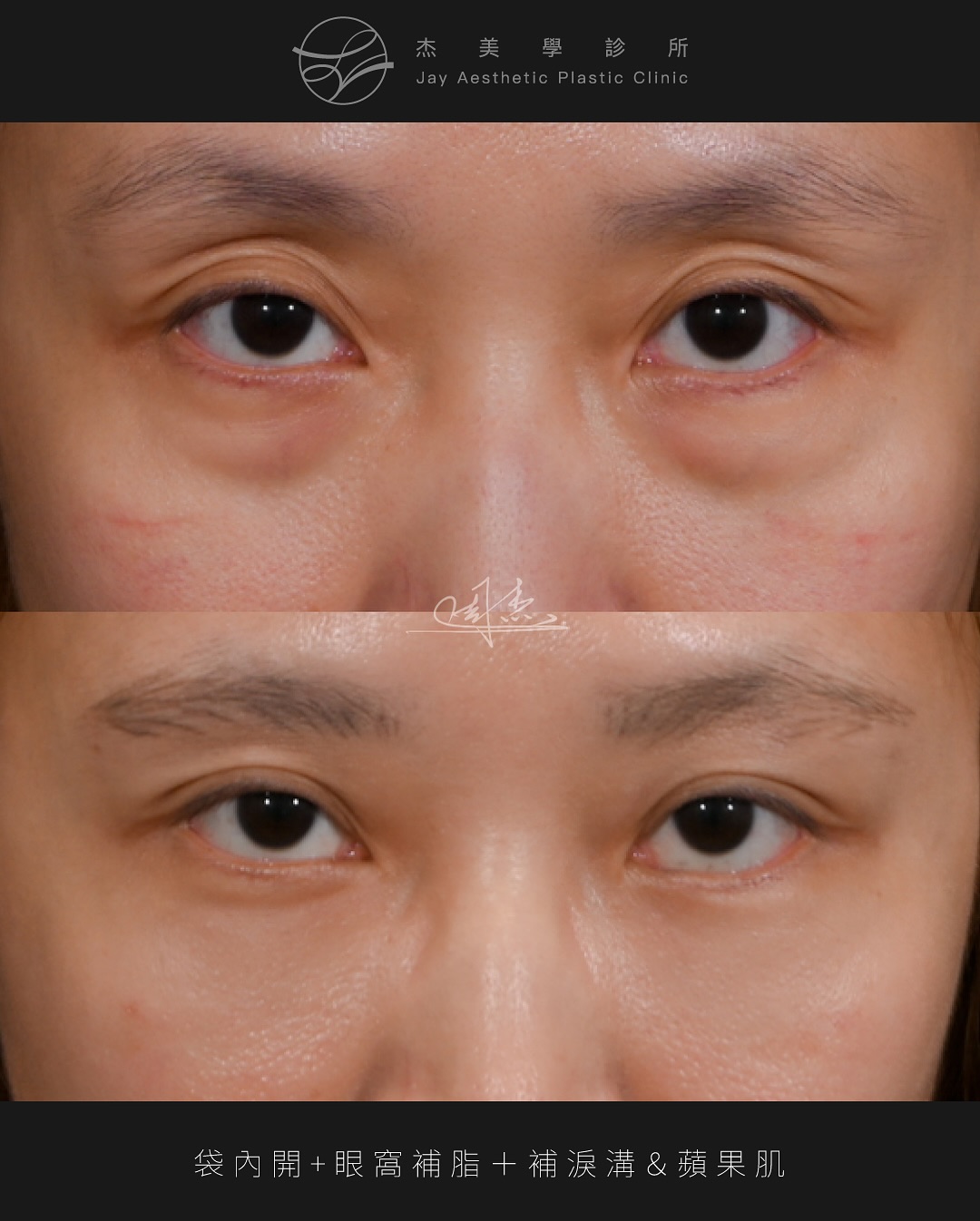 SnapInsta.to_518059437_18336000442160158_5411448679557059602_n