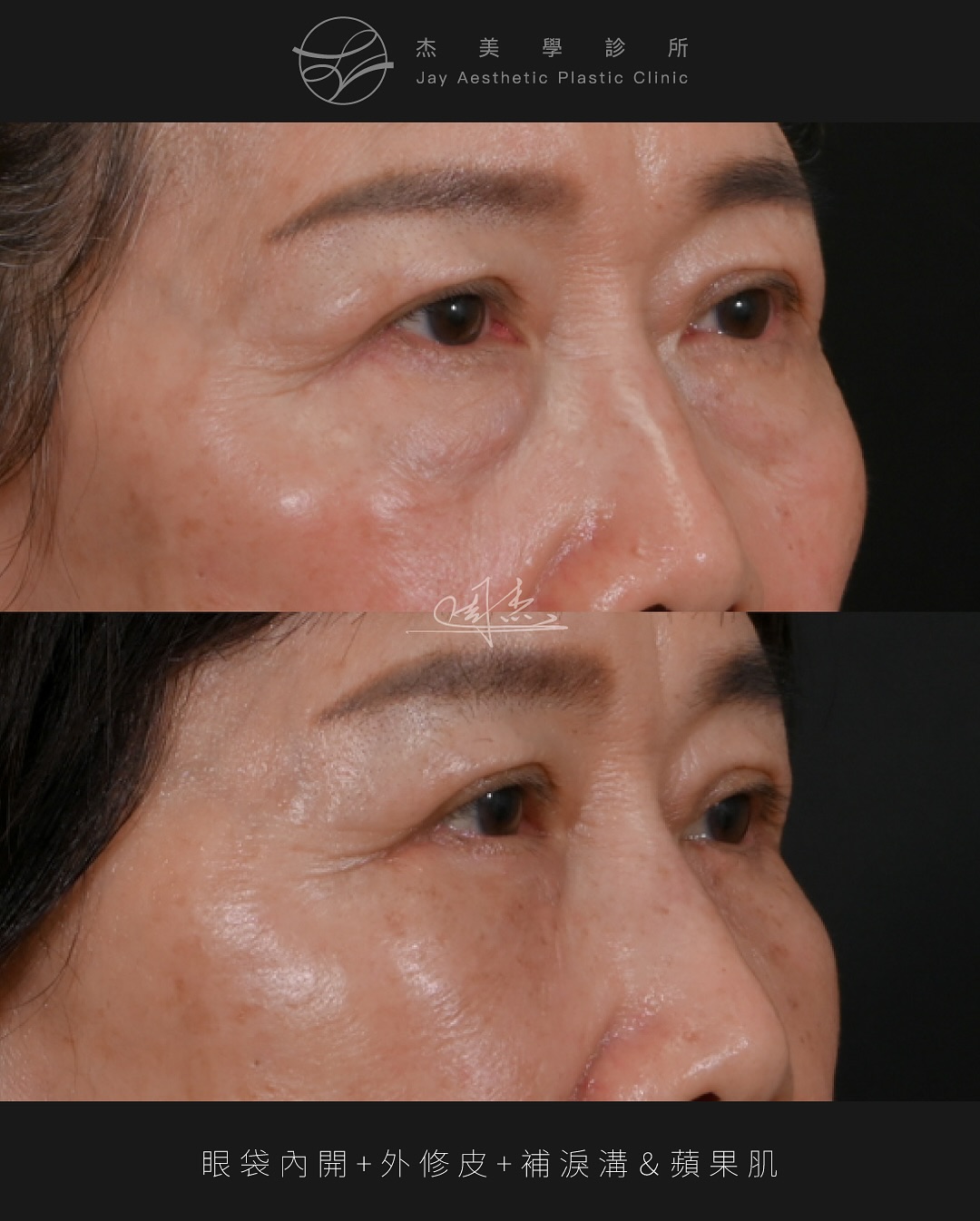 SnapInsta.to_519364090_18335602861160158_894110218006100810_n