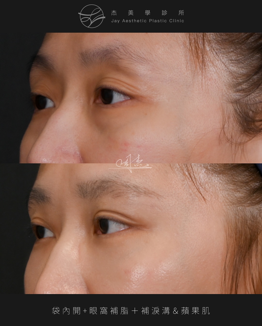 SnapInsta.to_520214224_18336000448160158_2349254375974002109_n