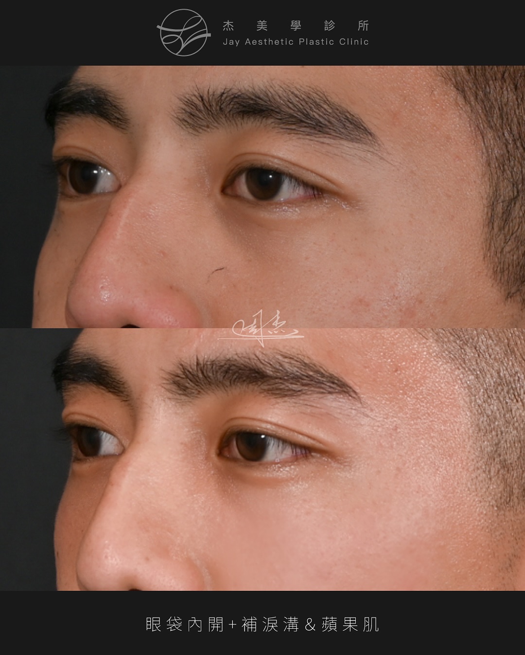 SnapInsta.to_525619002_18337399699160158_3866402629260093904_n