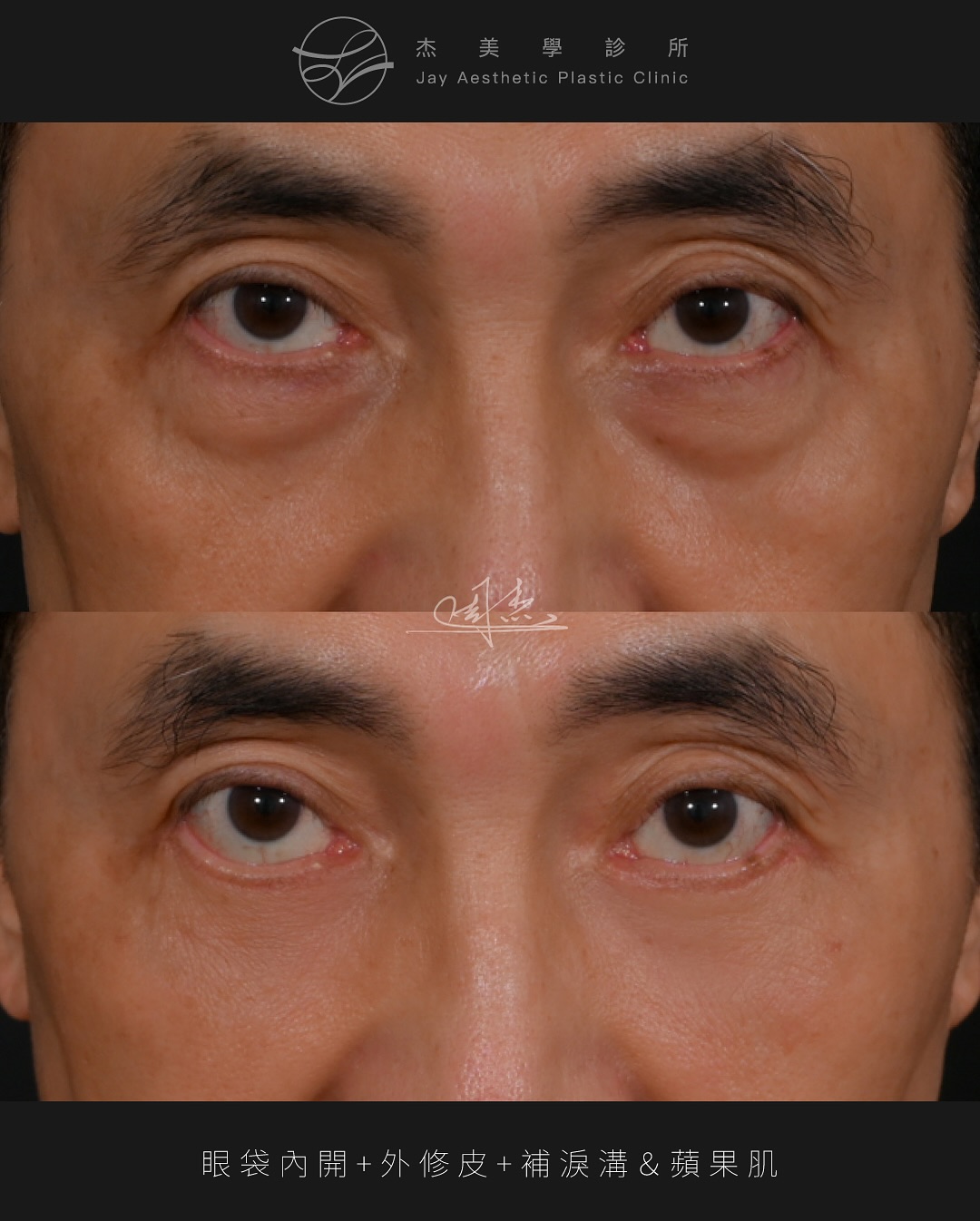 SnapInsta.to_525685558_18337398052160158_3130785703290227632_n