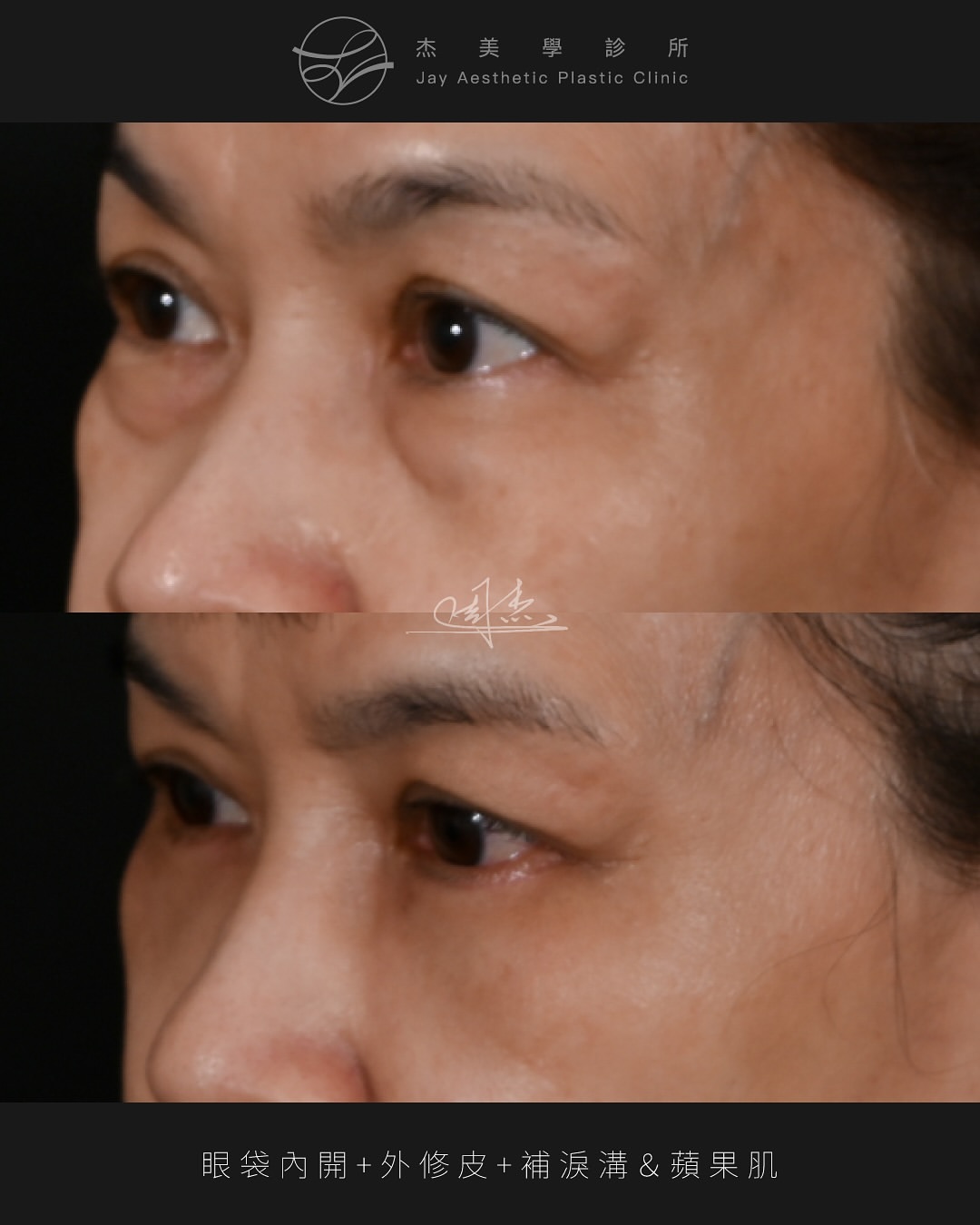 SnapInsta.to_530457975_18338650885160158_1804282617109587430_n