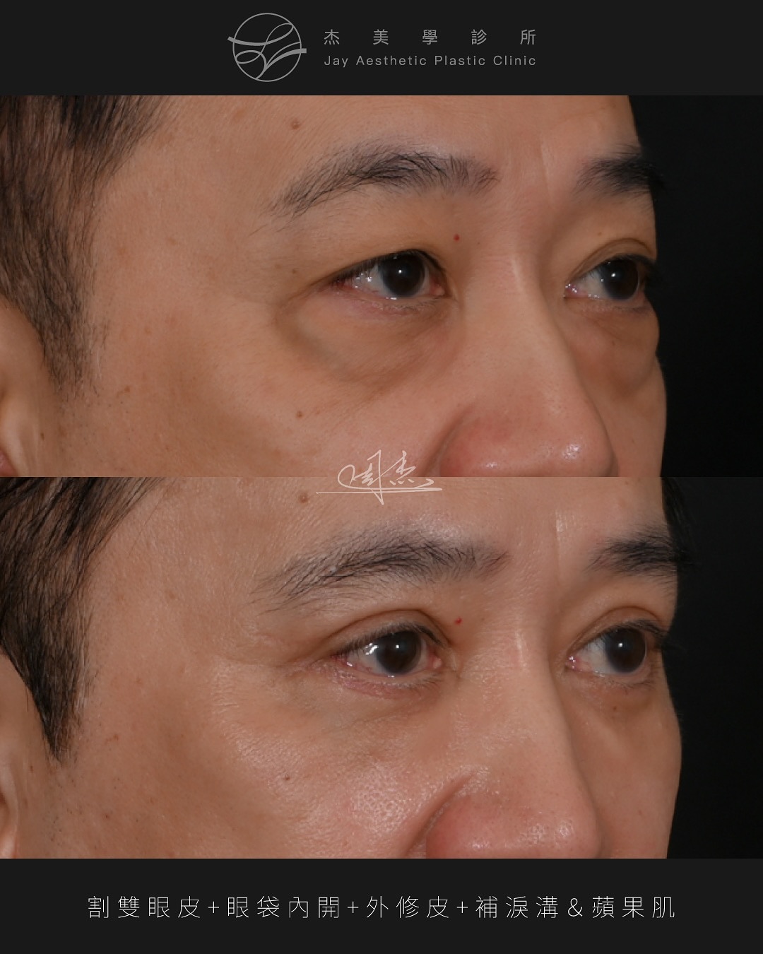 SnapInsta.to_532164574_18339165535160158_3983639728508255768_n