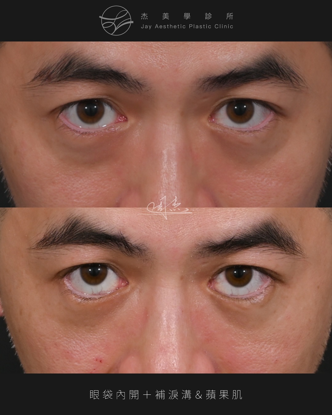 SnapInsta.to_540113945_18341111257160158_7541698730581879511_n