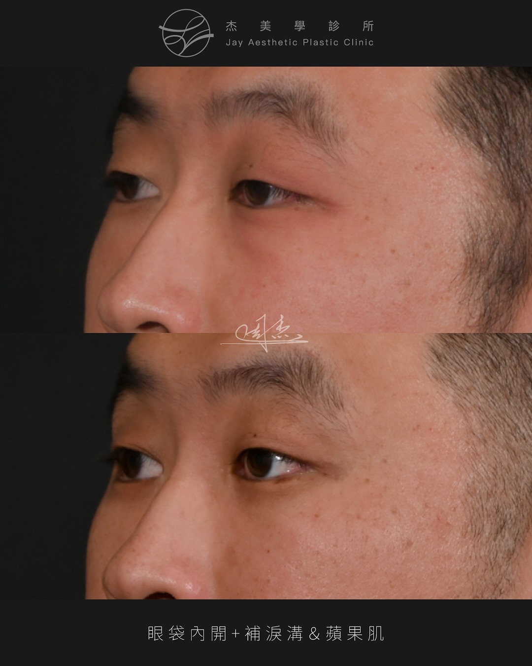 SnapInsta.to_542433349_18341697034160158_4971546194984682179_n