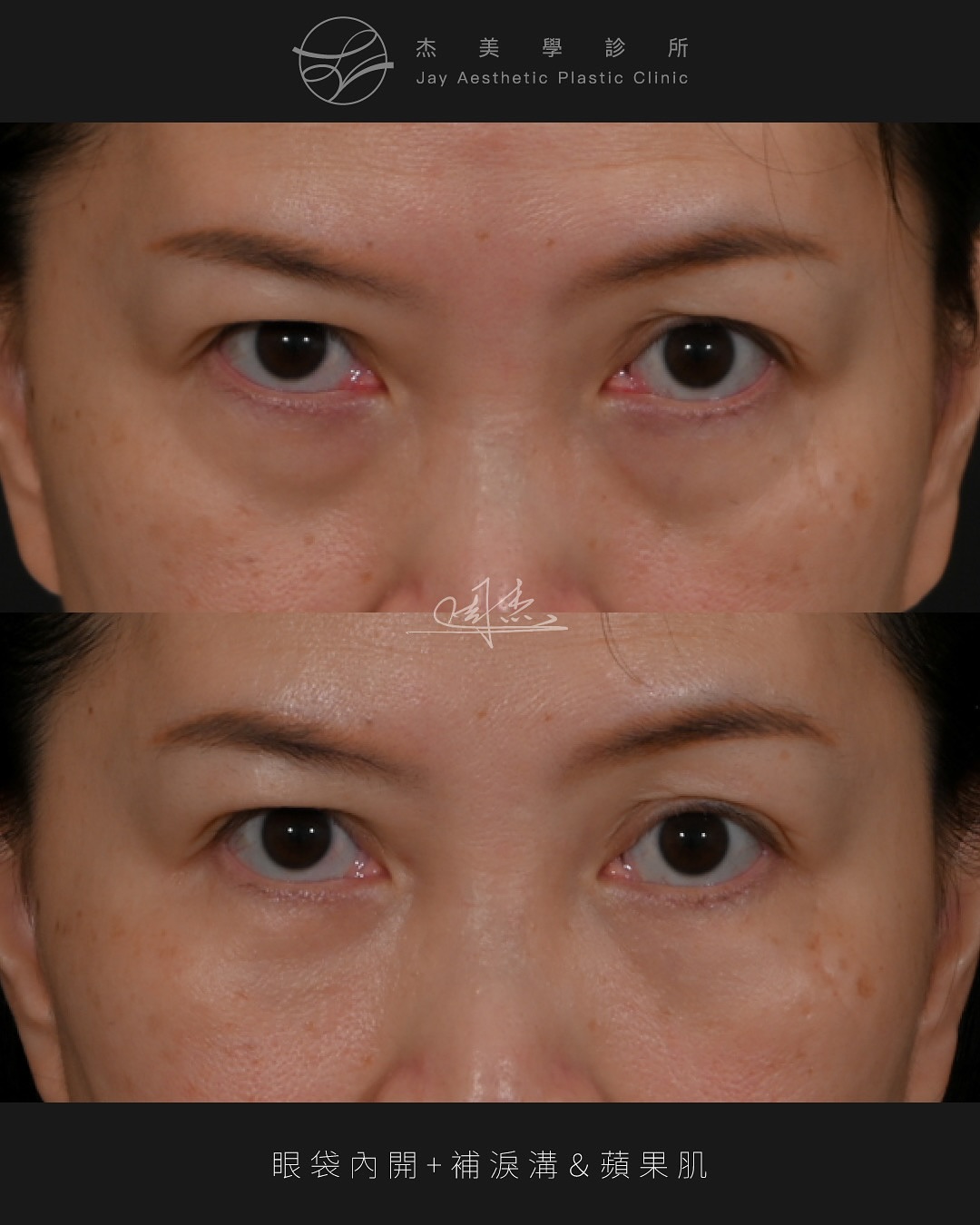 SnapInsta.to_550391002_18342708724160158_496293976243409164_n