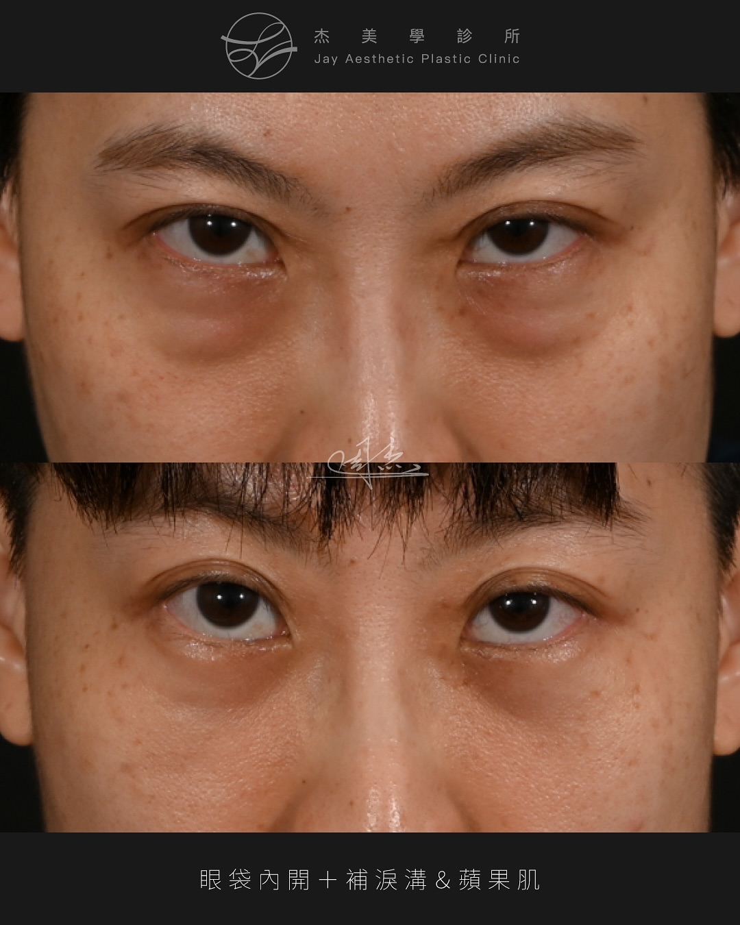 SnapInsta.to_569087307_18348024499160158_6239906053753217224_n