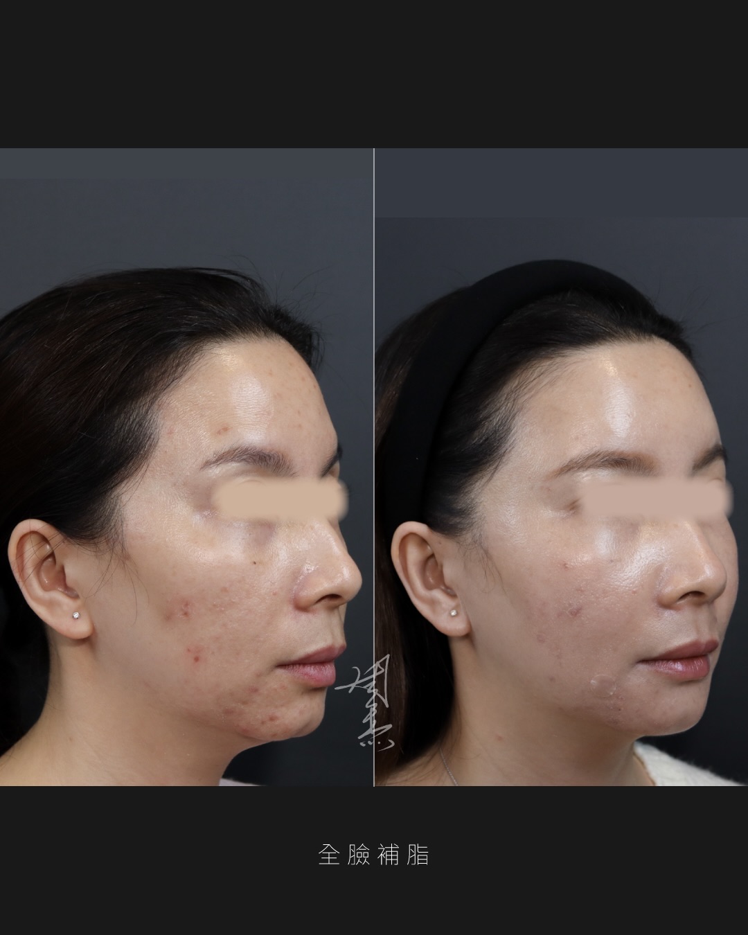 SaveClip.App_589907055_18353650798160158_3044173547509192075_n