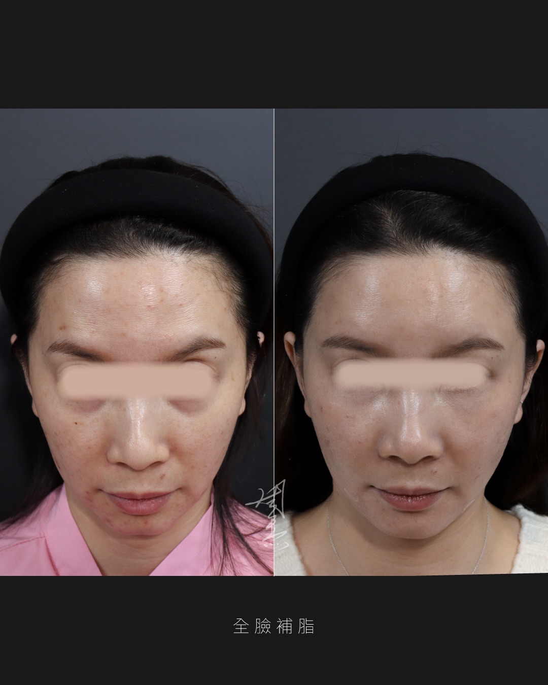 SaveClip.App_590850820_18353650786160158_169005378653193611_n