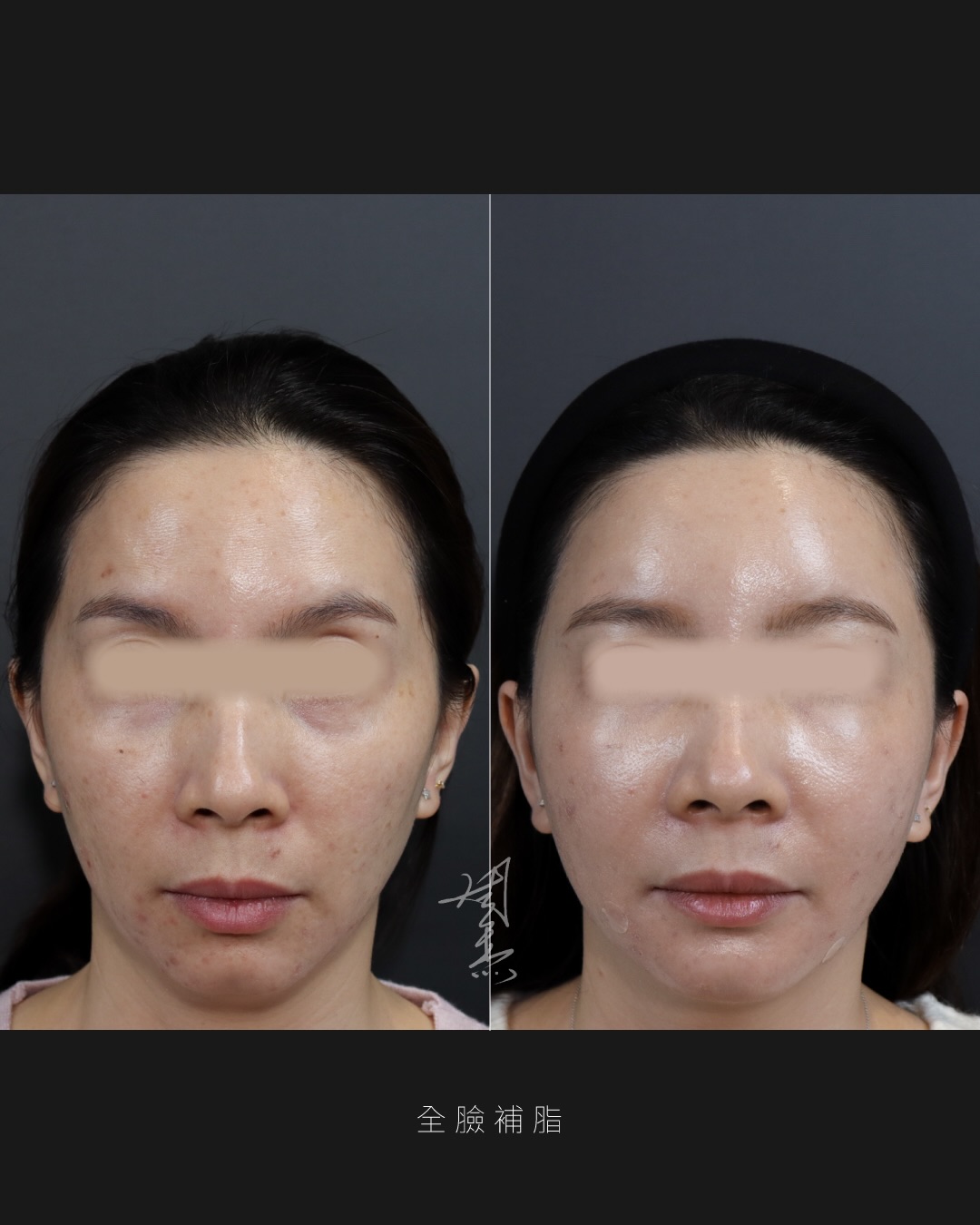 SaveClip.App_591164018_18353650768160158_3046491210276736169_n