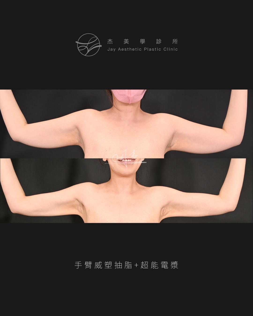 SaveClip.App_603944840_18355797655160158_4256966007993551114_n