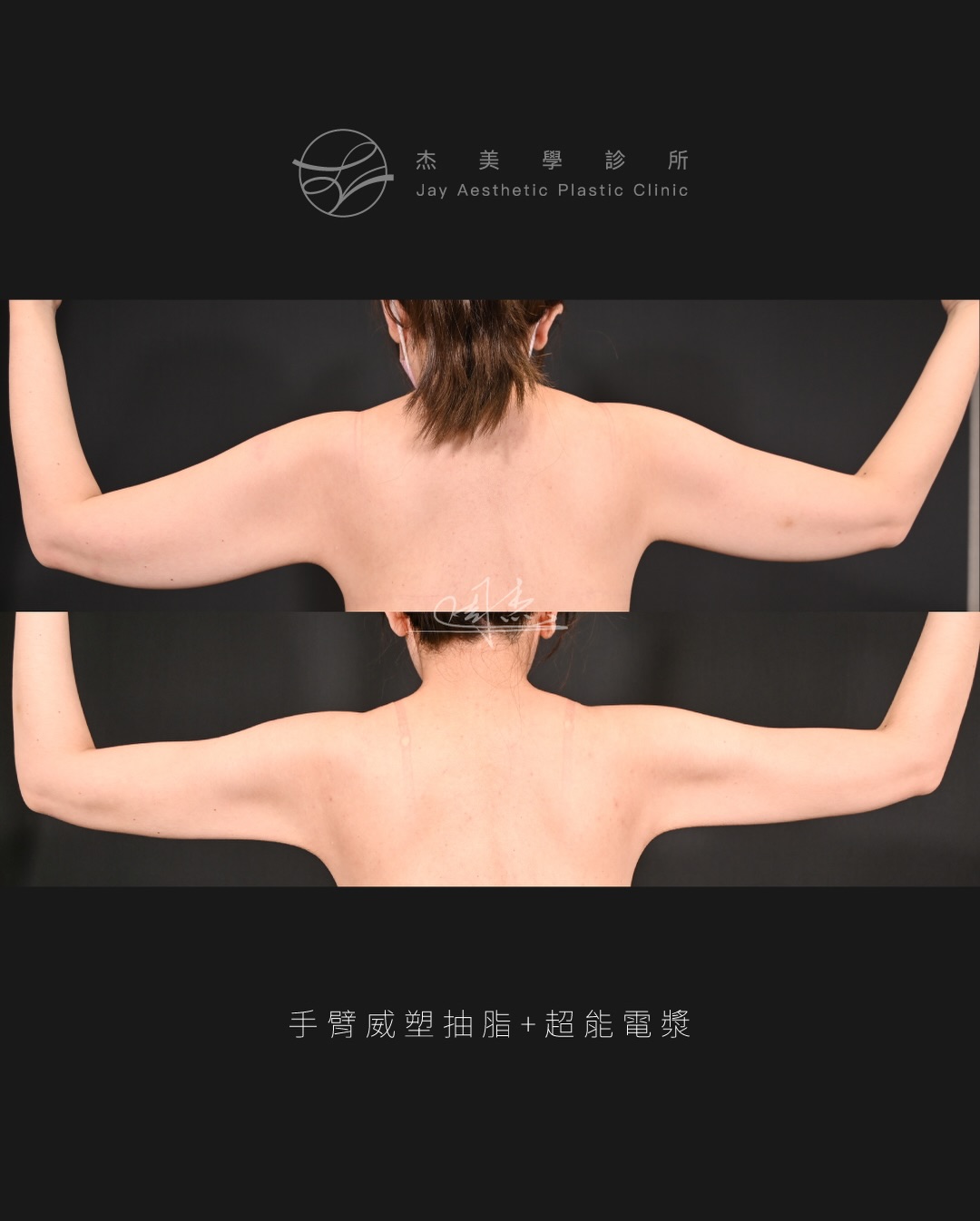 SaveClip.App_603945696_18355797670160158_7437485973524778138_n