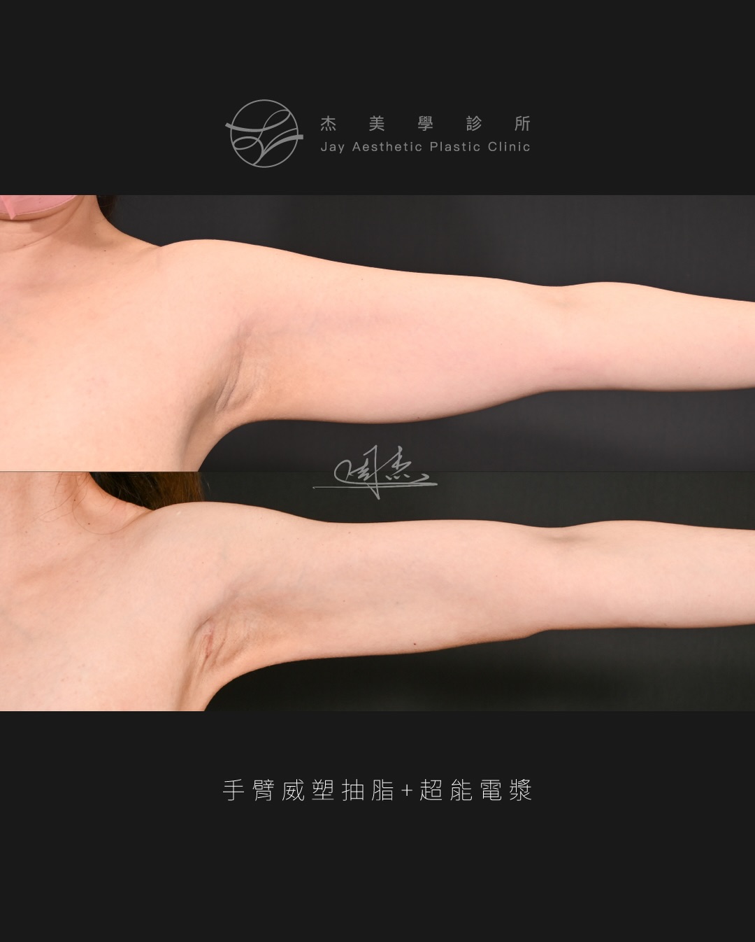 SaveClip.App_603963668_18355797691160158_6903239840554805834_n