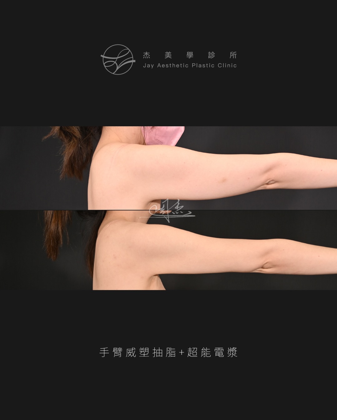 SaveClip.App_605142397_18355797673160158_7259956791575467906_n