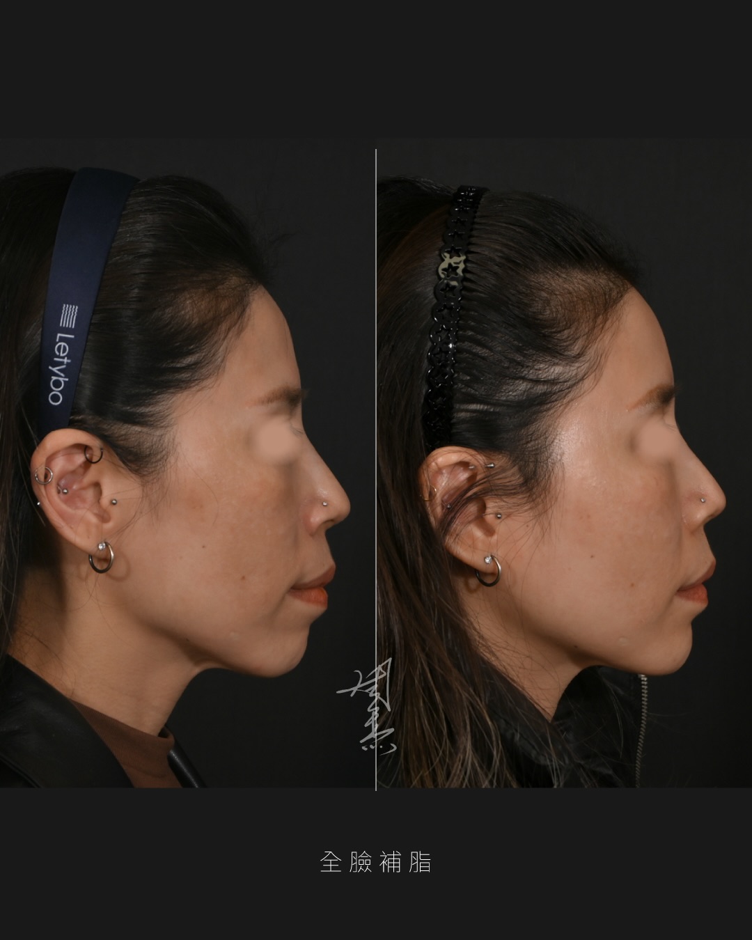 SaveClip.App_607725949_18356504428160158_7618661965964323634_n