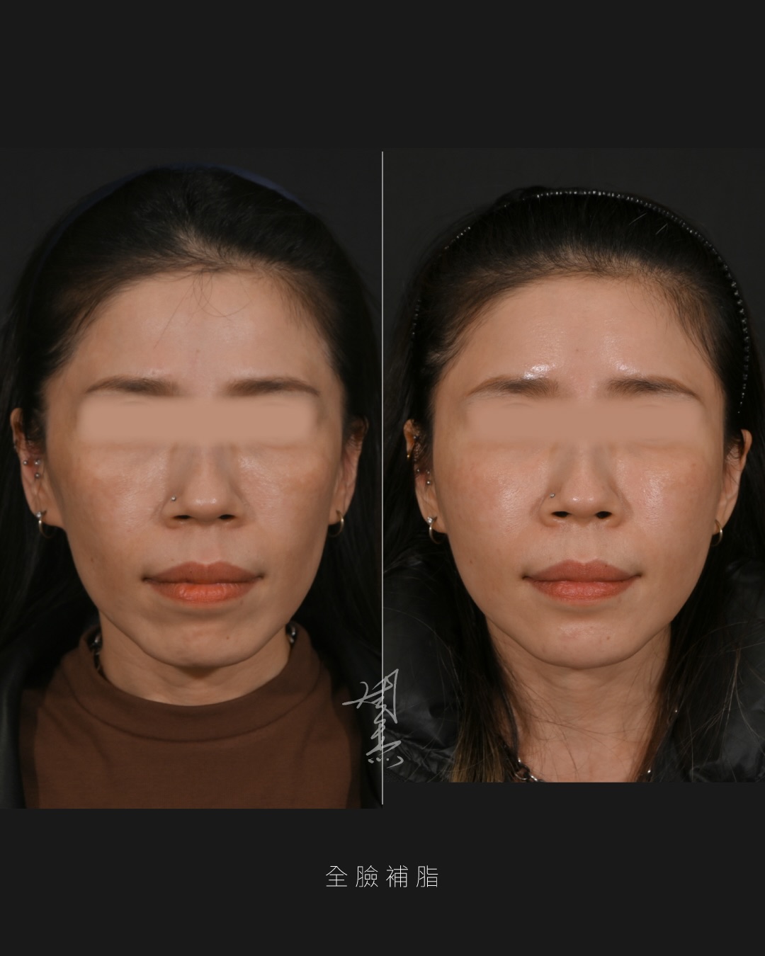 SaveClip.App_608744976_18356504392160158_6627119730332215823_n