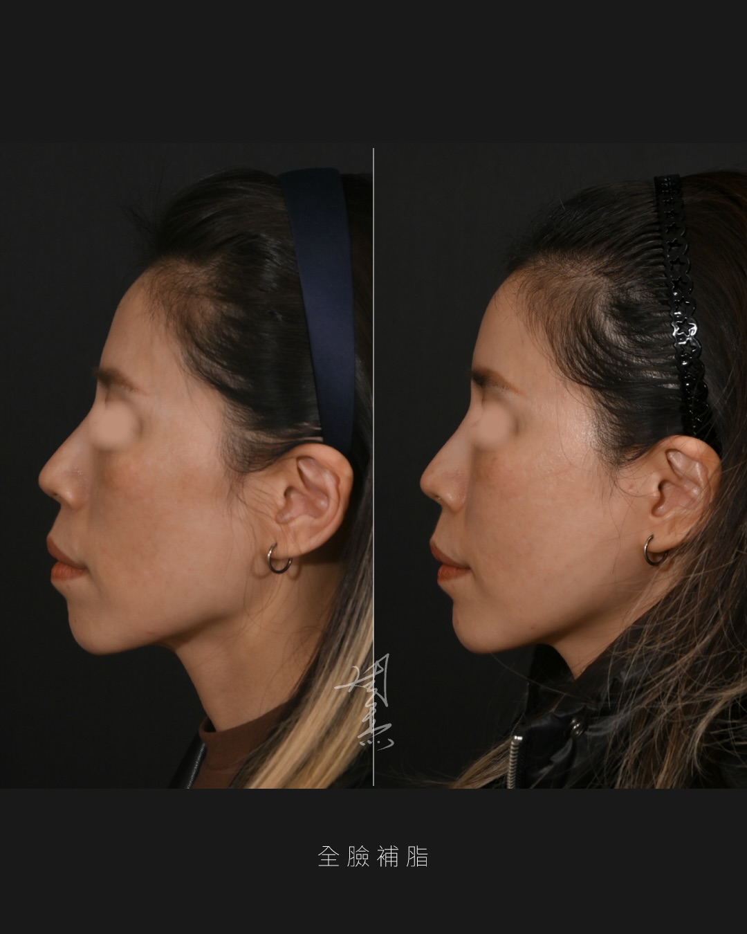 SaveClip.App_608757835_18356504419160158_4614225758562433846_n