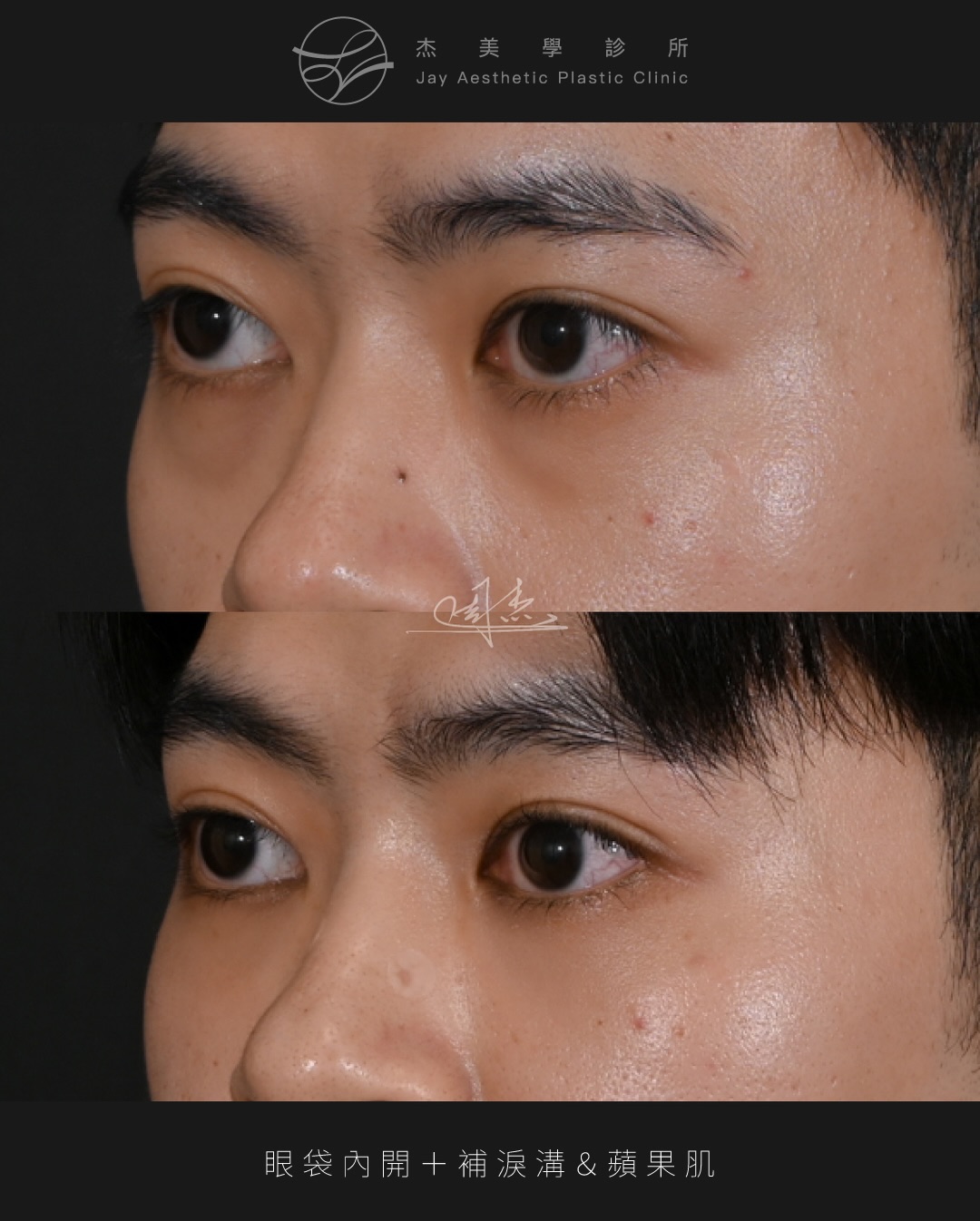 SaveClip.App_591555429_18357244840160158_7720219016321488971_n