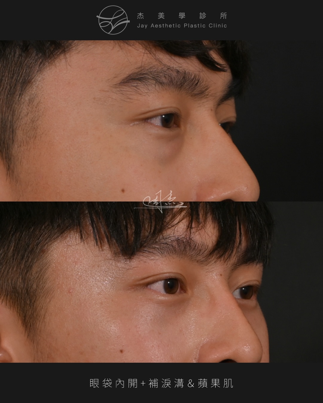 SaveClip.App_609674927_18356961904160158_2901567180952740867_n