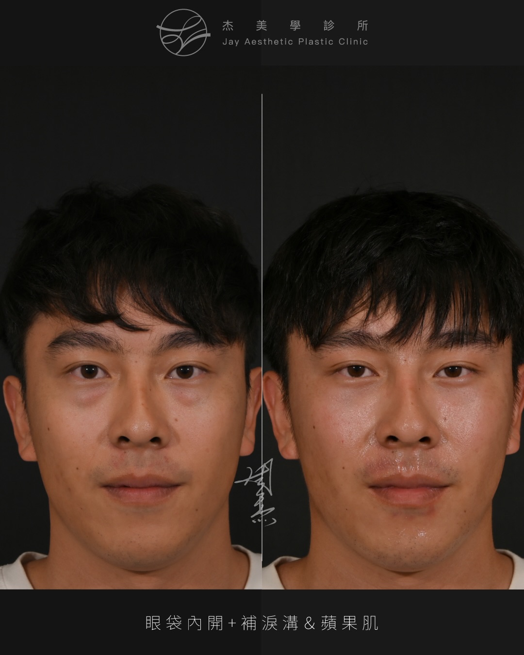 SaveClip.App_610028171_18356961922160158_9089365808162517807_n