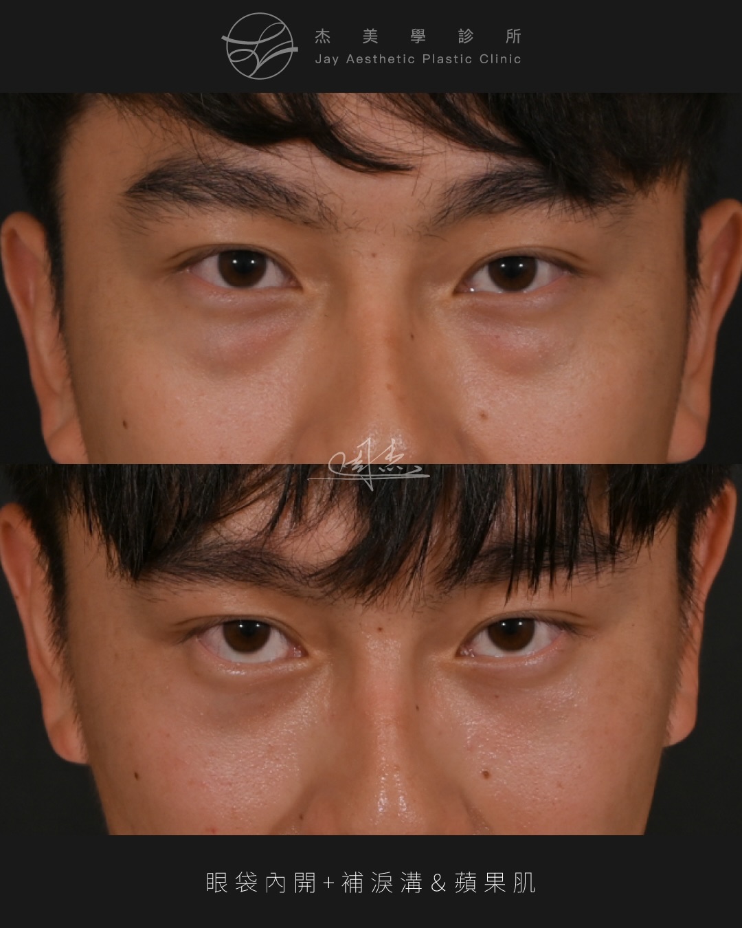 SaveClip.App_610880191_18356961913160158_7267533740196087801_n