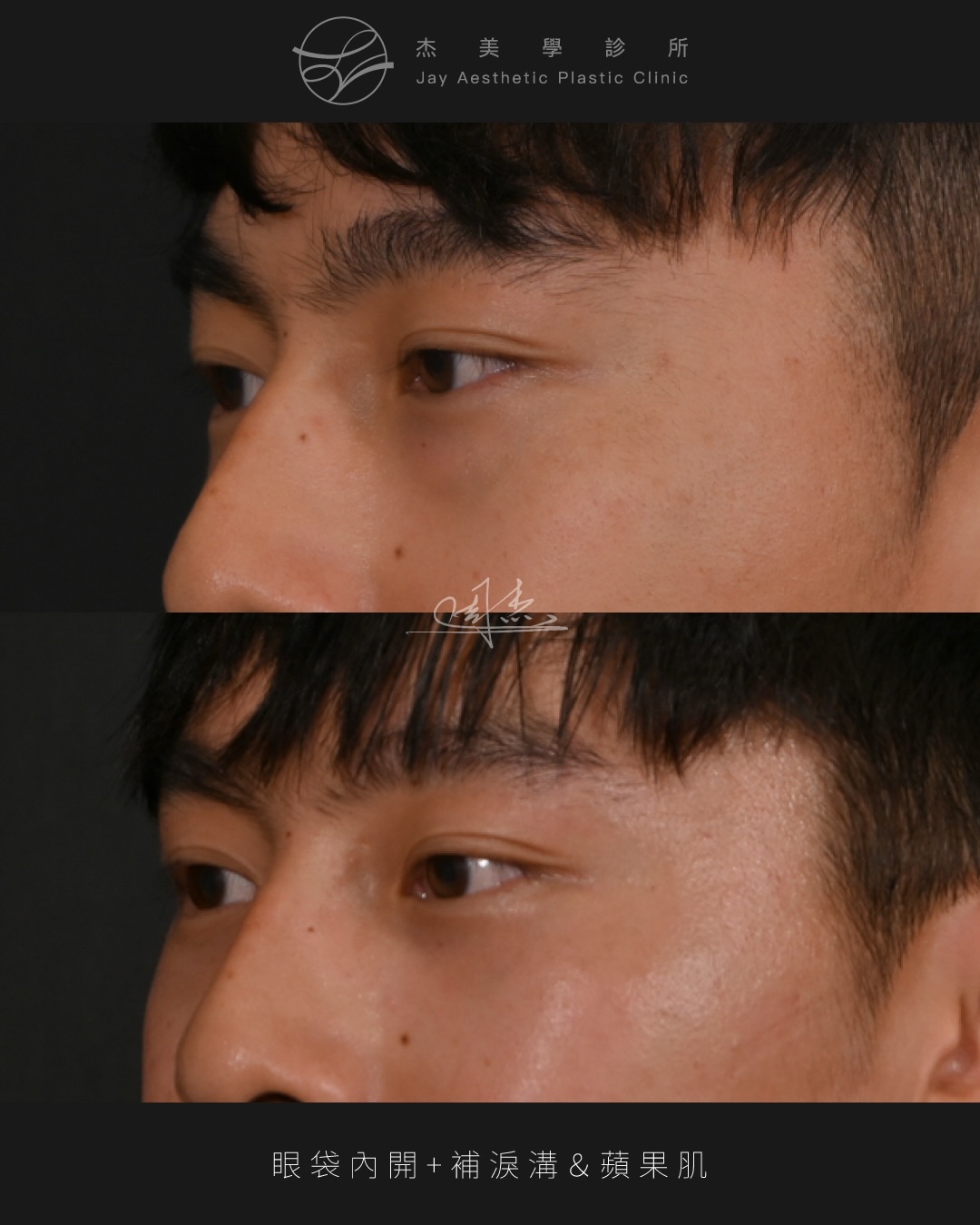 SaveClip.App_610921943_18356961895160158_6171672832312315711_n