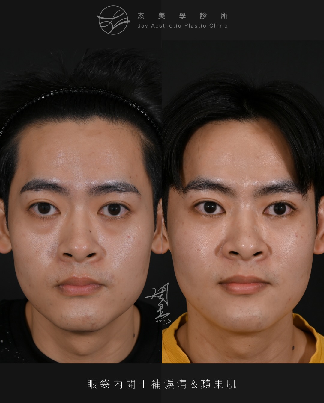 SaveClip.App_611244891_18357244873160158_7582786966126629786_n