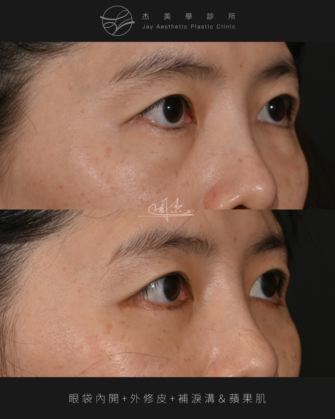 SaveClip.App_620323663_18359178721160158_6505885979315847320_n