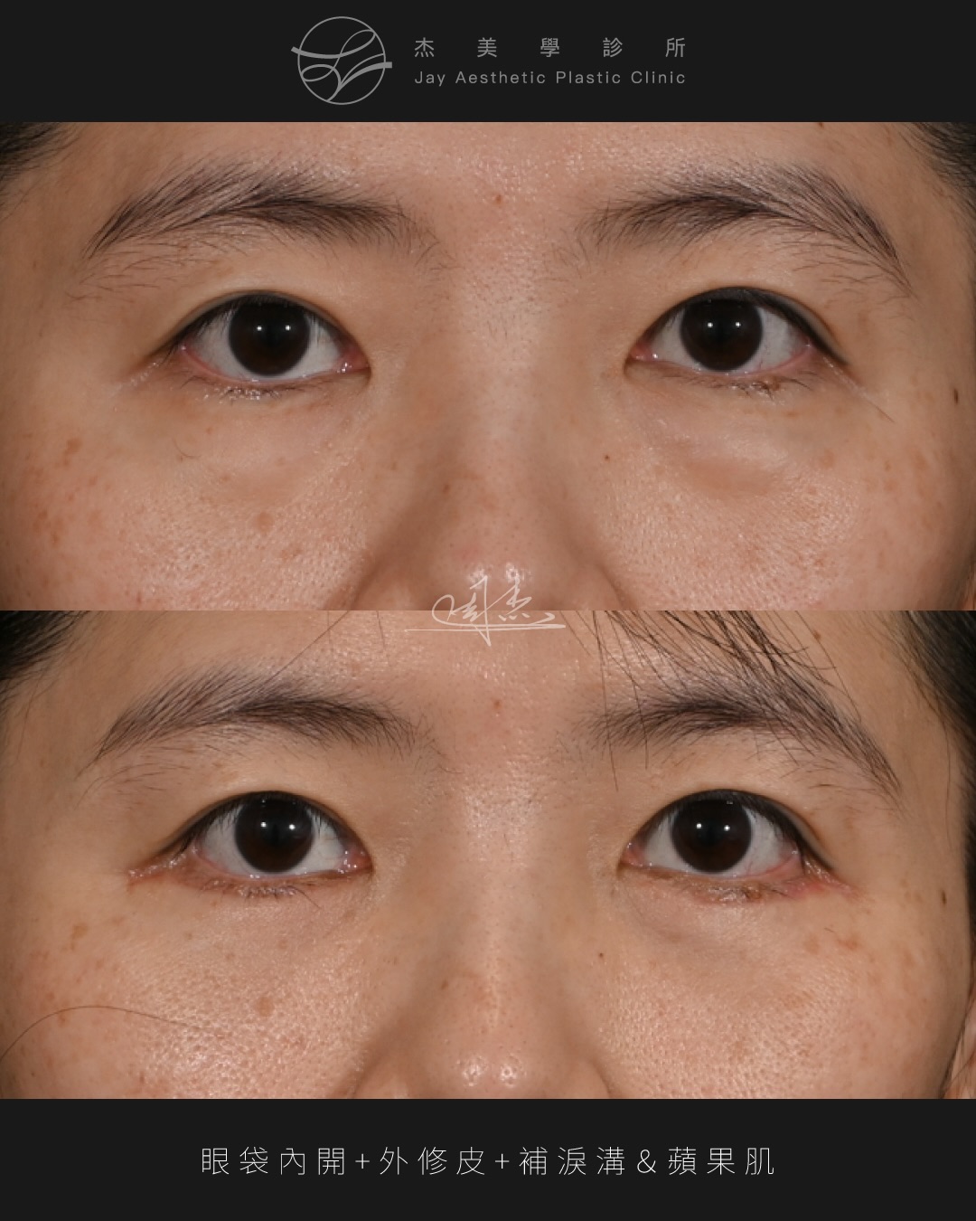 SaveClip.App_620533780_18359178712160158_7206826552624941563_n