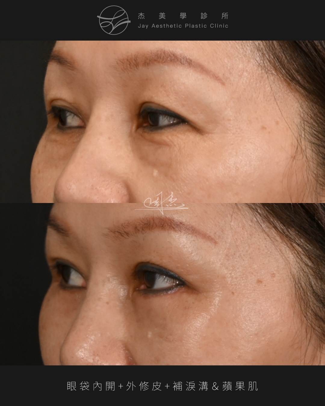 SaveClip.App_621427907_18359526841160158_6372438631073063779_n