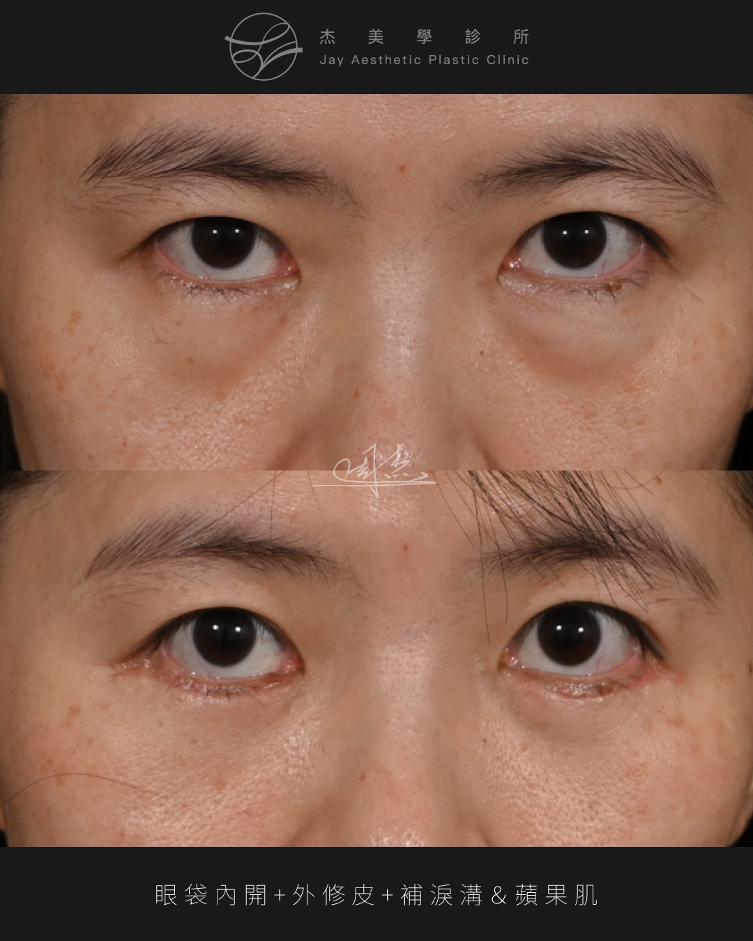 SaveClip.App_622140622_18359178736160158_7060616731715315816_n