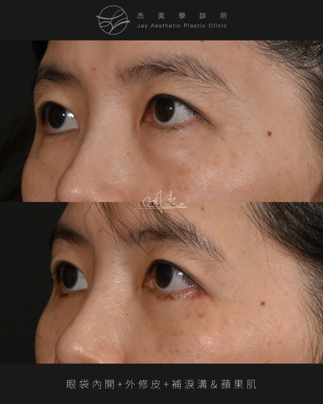 SaveClip.App_622158448_18359178739160158_2008944222654166348_n