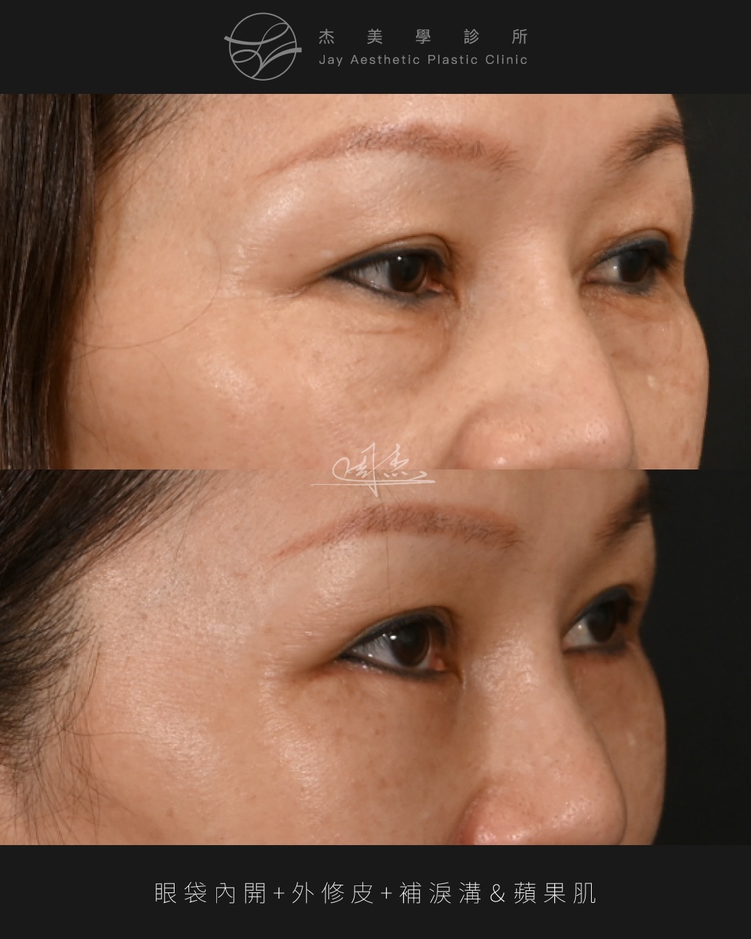 SaveClip.App_622459913_18359526844160158_7158069410841396103_n