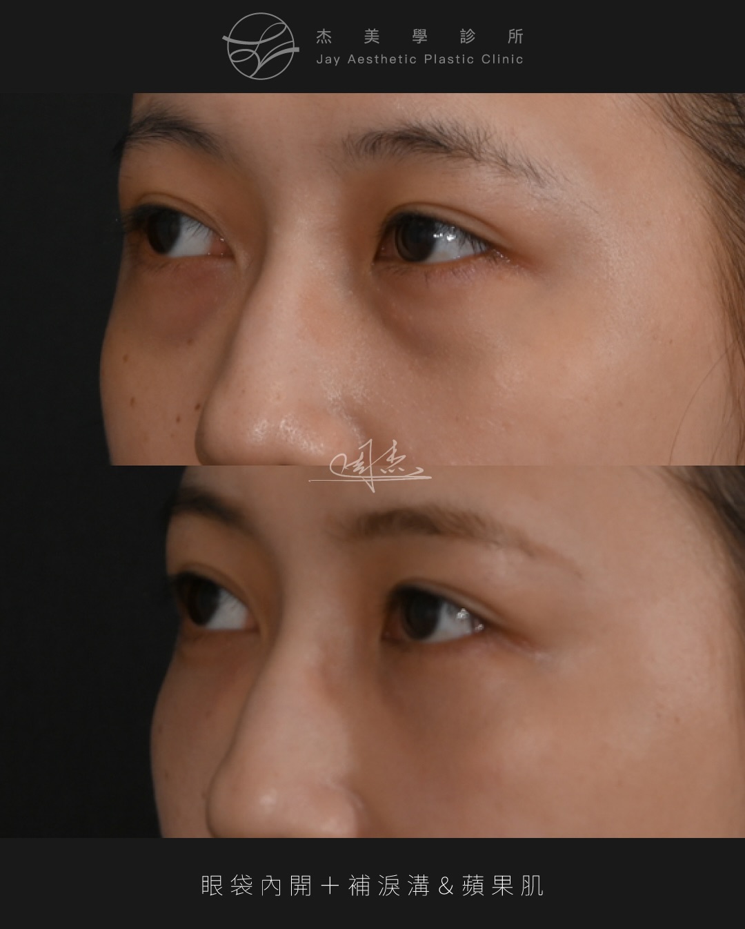 SaveClip.App_622972721_18359794381160158_819307333263737943_n