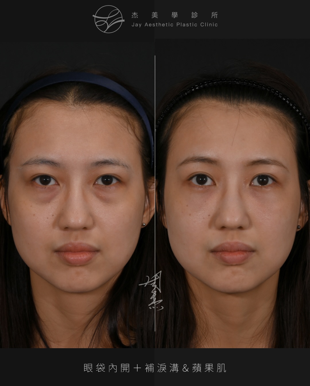 SaveClip.App_623831254_18359794399160158_1701704939855753358_n