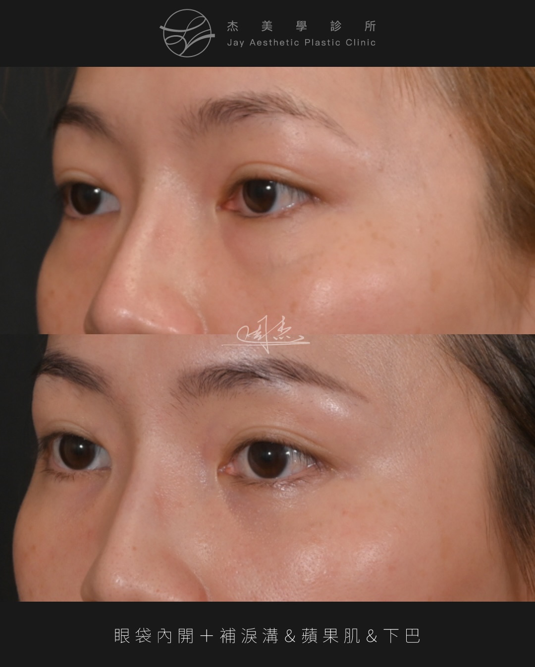 SaveClip.App_625214694_18360795181160158_7971752561742258689_n