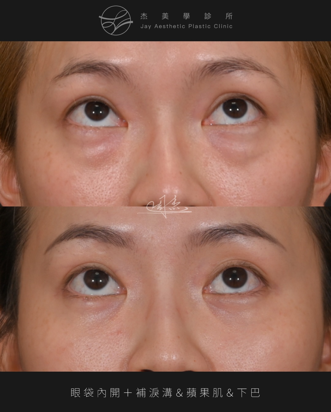 SaveClip.App_625256389_18360795190160158_3375433309749382014_n