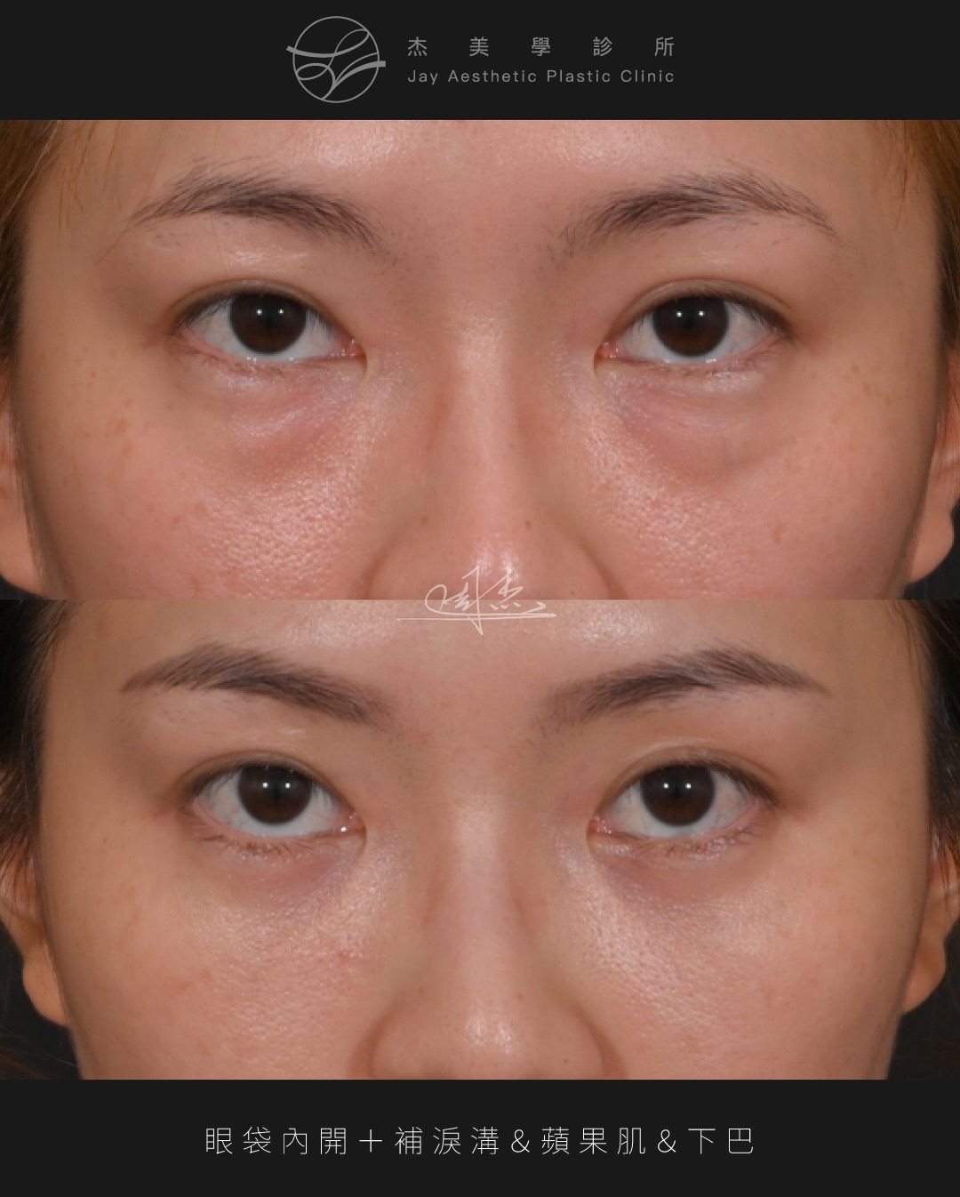 SaveClip.App_626192703_18360795163160158_1860522417706604110_n