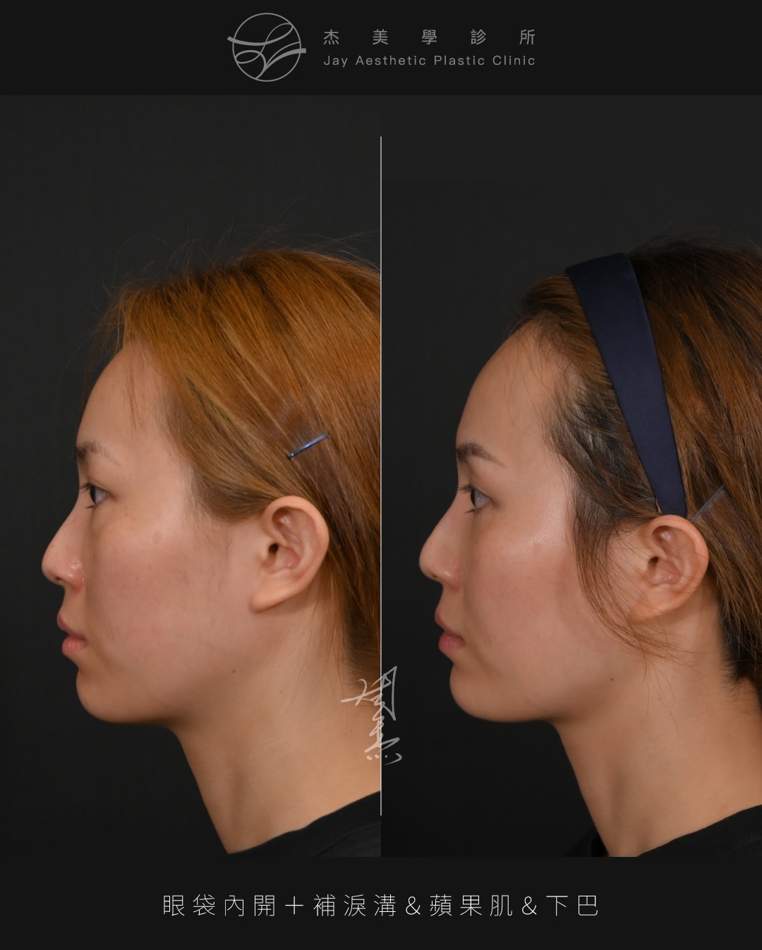 SaveClip.App_626693369_18360795199160158_4187179122255110235_n