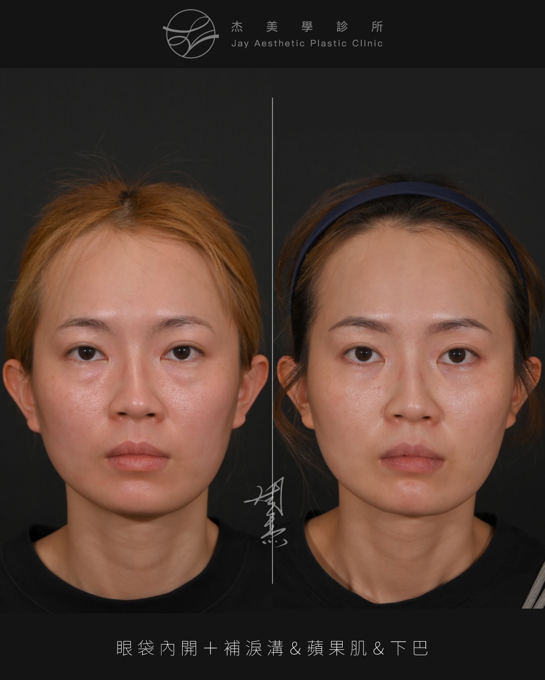 SaveClip.App_627500155_18360795217160158_8912312605293367487_n